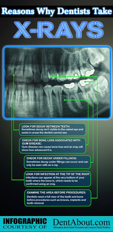 Dental X-Rays